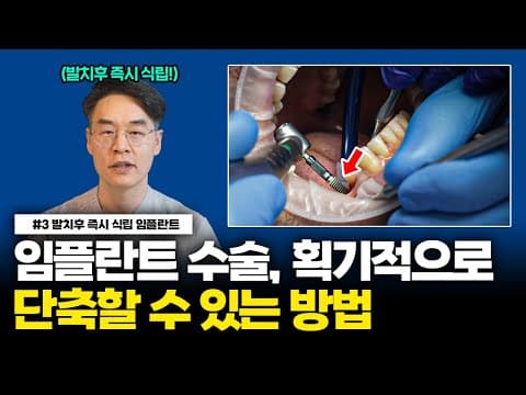 뼈이식? 임플란트 식립? 단 하루면 끝납니다 / 서울대 치과 의사가 알려주는 "발치 후 즉시 식립 임플란트"