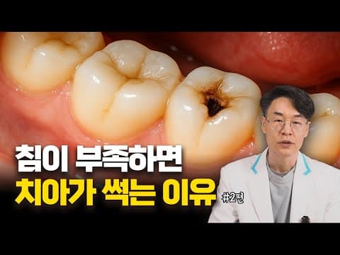 침이 부족하면 충치가 많이 생기는 이유는?? / 서울대 출신 치과의사가 알려드립니다