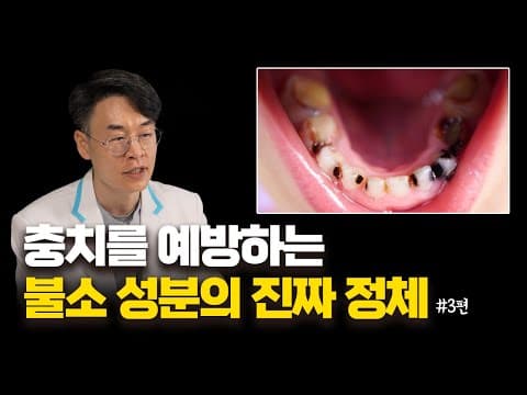 불소 성분 진짜 치아를 좋게 만들어 주는 걸까? 충치와 불소의 상관 관계 / 서울대 출신 20년 경력 치과원장님의 충치 시리즈 3편