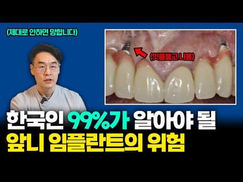 다른 임플란트와는 다르다! 앞니 임플란트가 진짜 어려운 이유! / 서울대 치과 의사의 임플란트 이야기